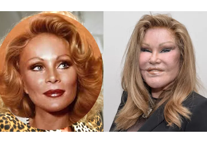 Jocelyn Wildenstein, muere, famosa, gata, cirugías plásticas, EEUU